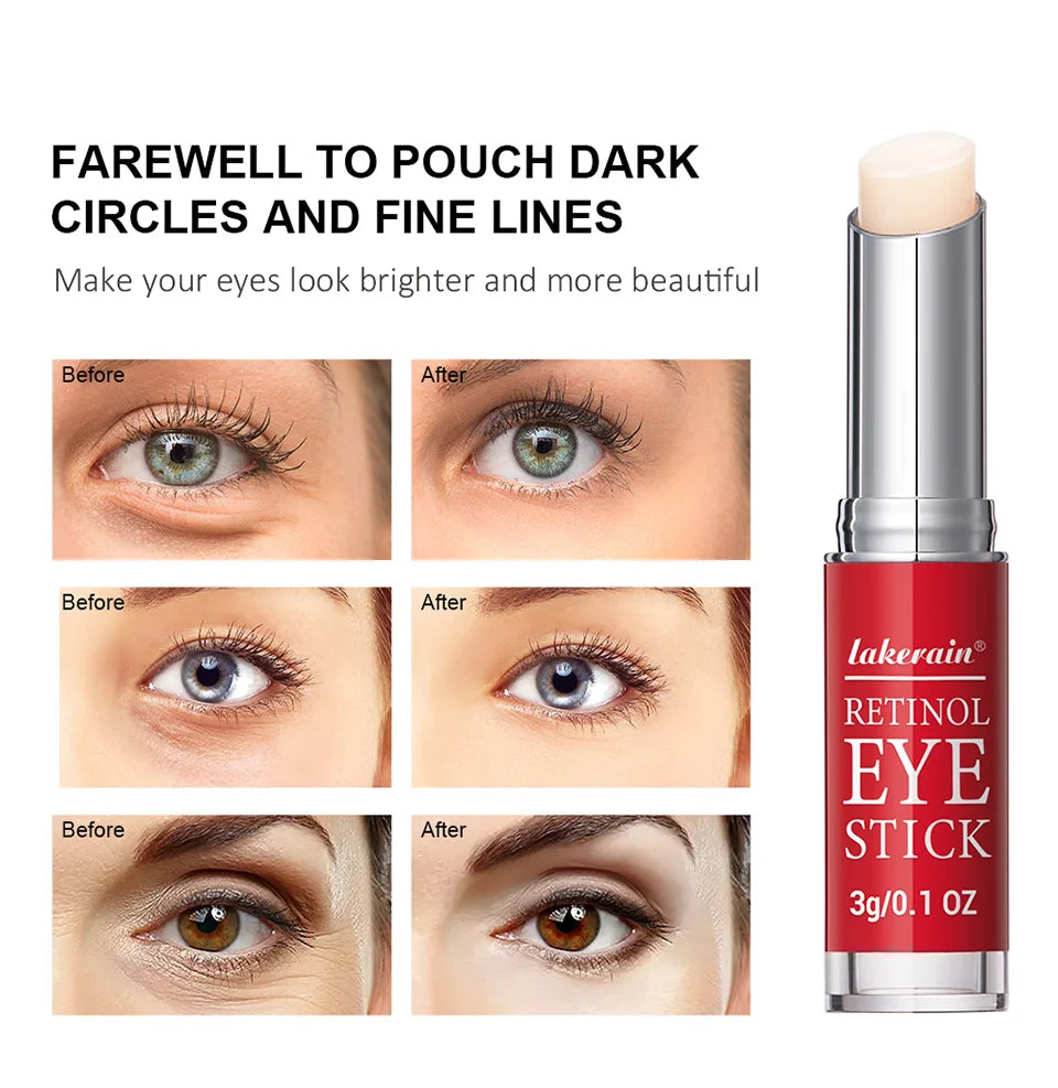 Retinol Eye Cream Stick – Lightens Dark Circles & Firms Skin Instantly