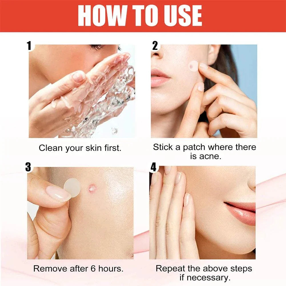Steps showing how to use high-end acne patches including cleaning skin, applying patch on acne, removing after 6 hours, and repeating as needed.