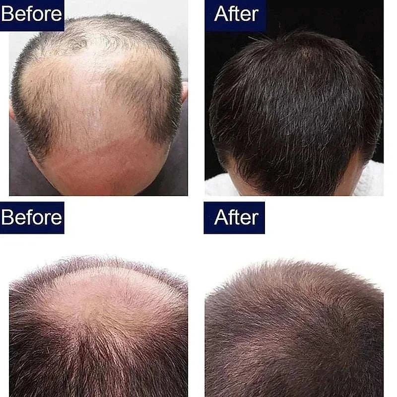 Before and after results showing improved hair density and thickness after using 7 Day Rapid Growth liquid anti hair loss treatment