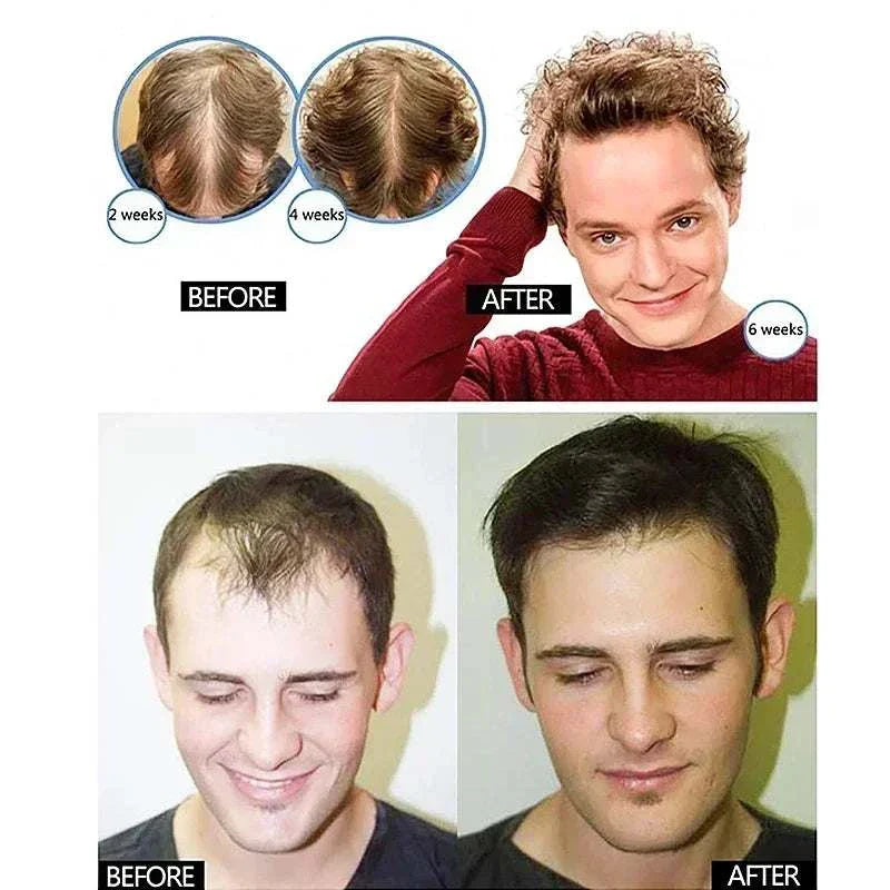 Before and after photos showing hair regrowth progress using 7 Day Rapid Growth Liquid Anti Hair Loss Treatment with ginger extract on men over weeks.
