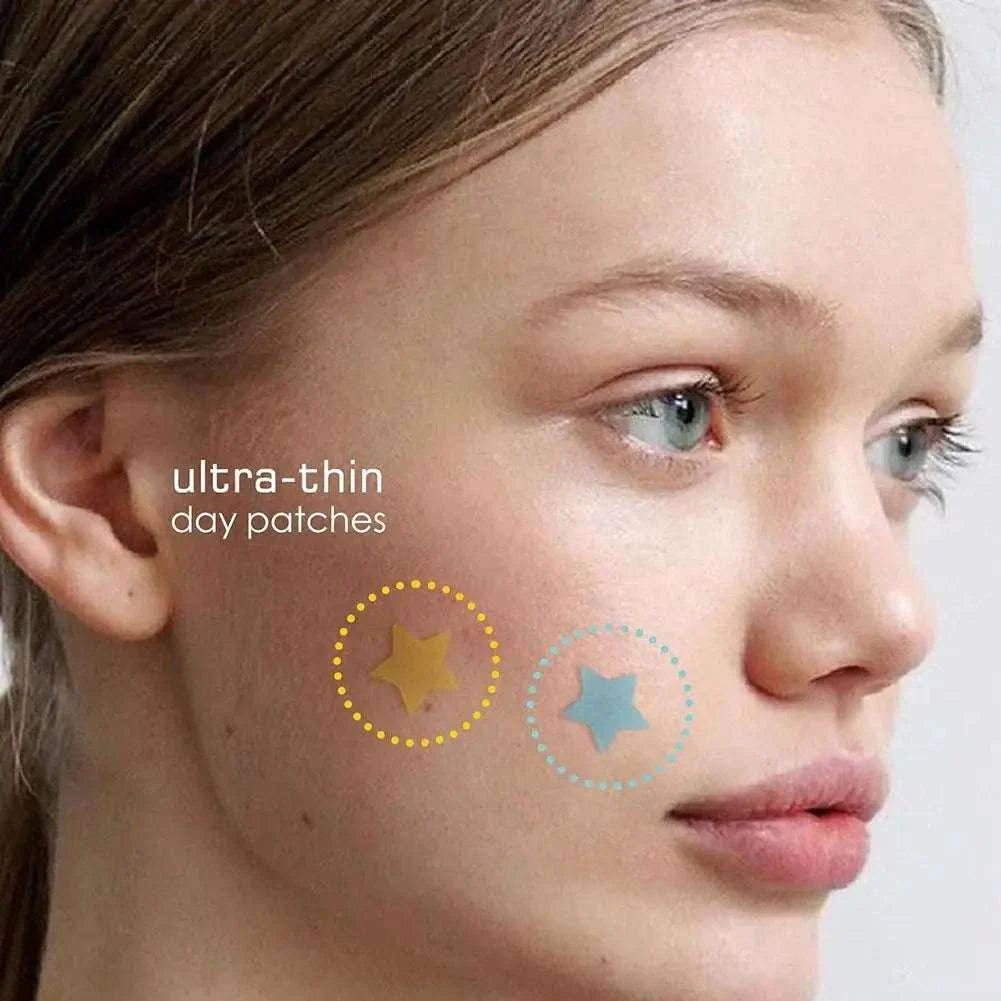 Close-up of a woman's face showing ultra-thin colorful star-shaped pimple patches on her cheek for acne treatment