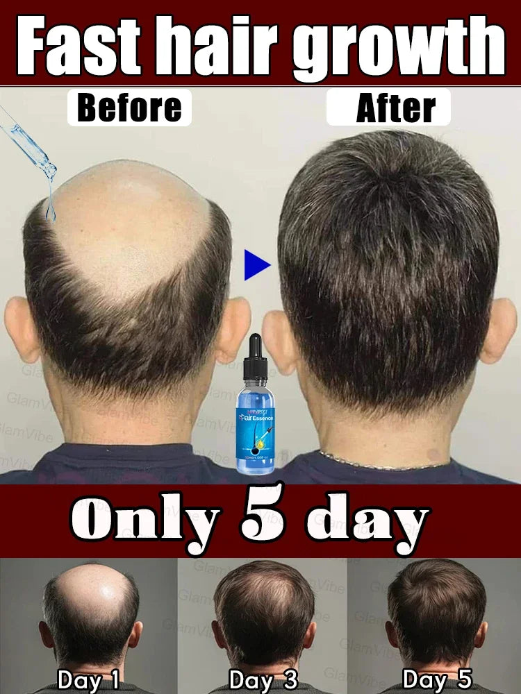 Blue Bottle Hair Growth serum before and after results showing fast hair growth in 5 days