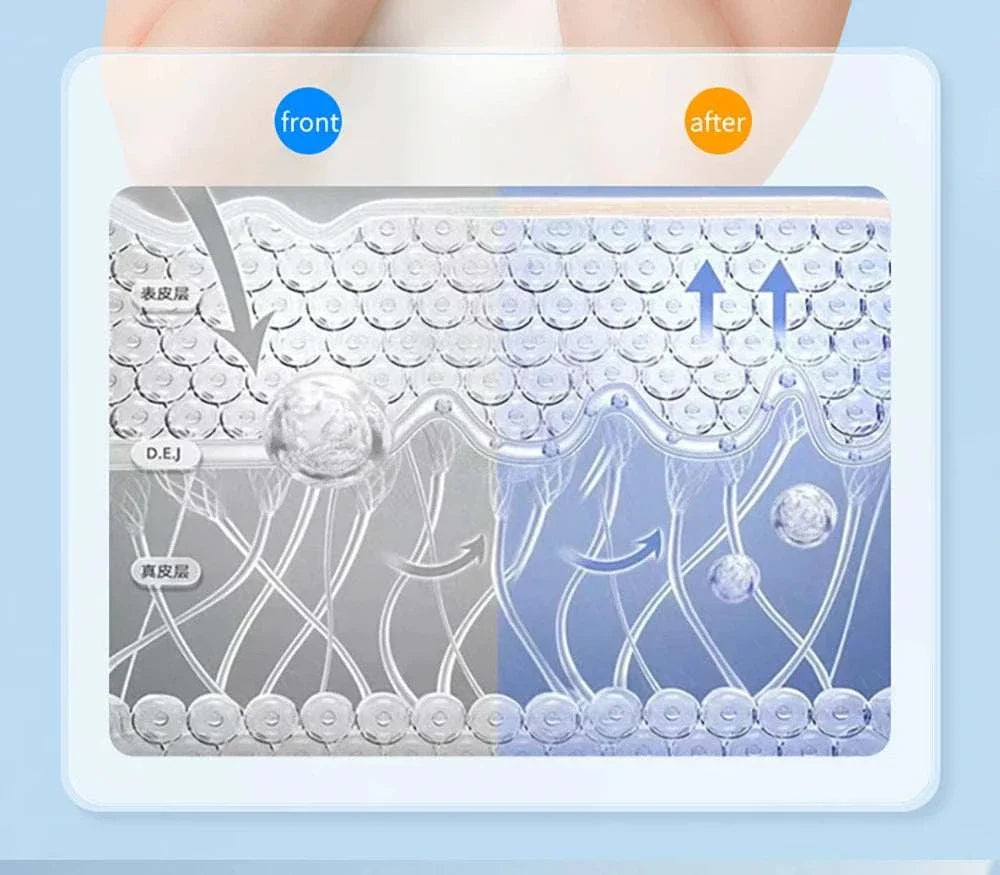 Diagram showing skin layers before and after using EMS Face Lifting Massager enhancing skin firmness and rejuvenation