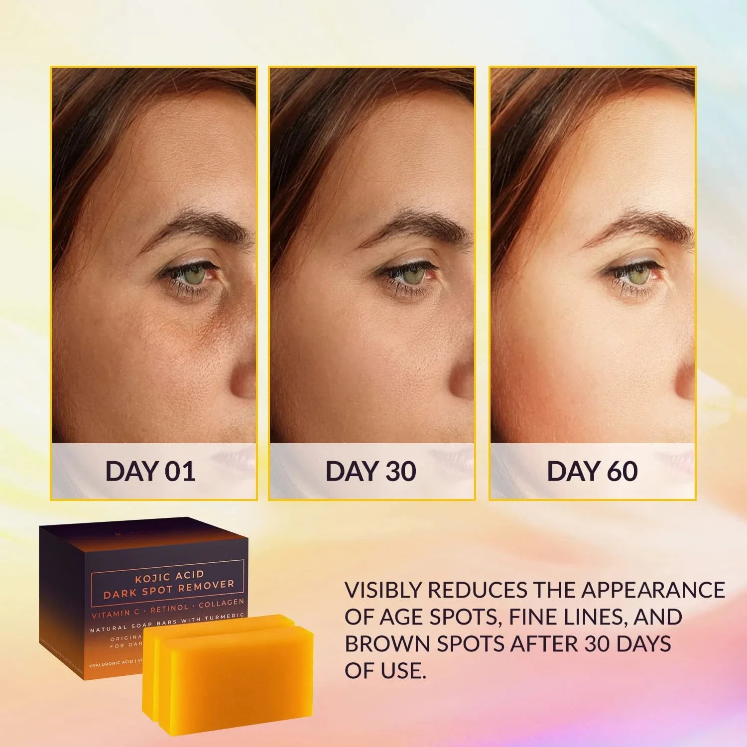 Kojic Acid Dark Spot Remover Whitening Soap