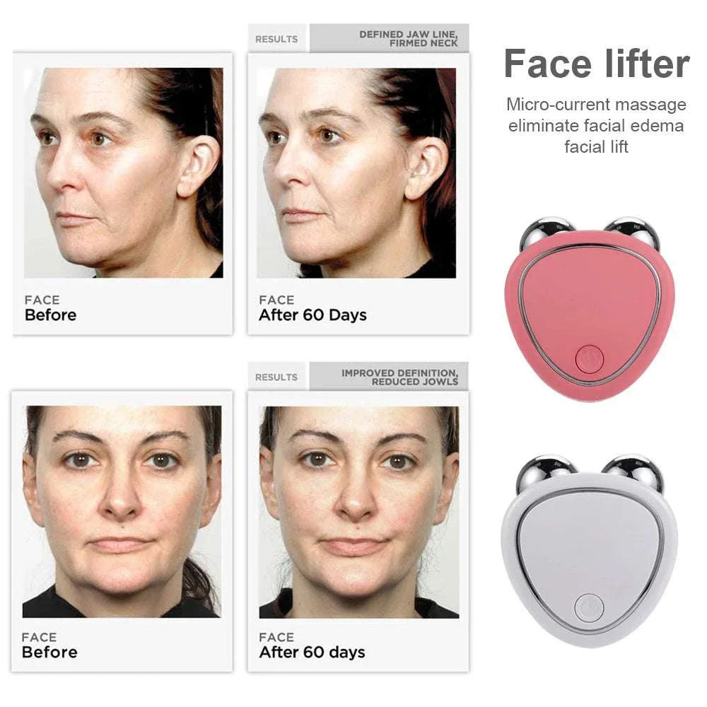 EMS Face Lifting Machine with microcurrent rollers shown with before and after 60 days facial skin tightening results